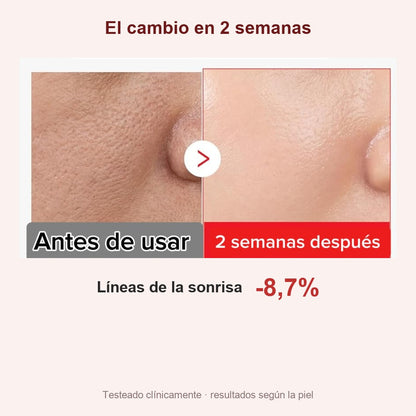 Sérum Lifting de NAD+ Sangre de Vampiro (30ml)