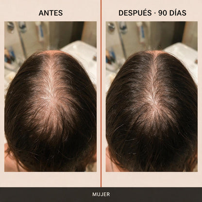 Lilyeve · Ampolla Capilar Coreana — «Gira & Densifica»